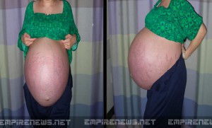 woman pregnant with 10 babies