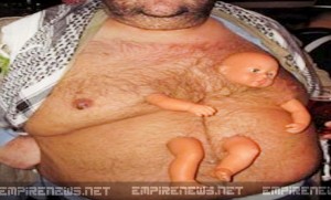 Man Has Baby Doll Surgically Implanted In His Body
