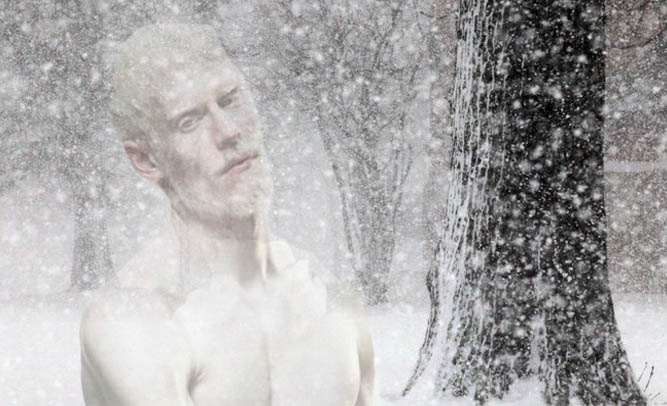 New England Albino Man Goes Missing During Snowstorm, Police Still Searching